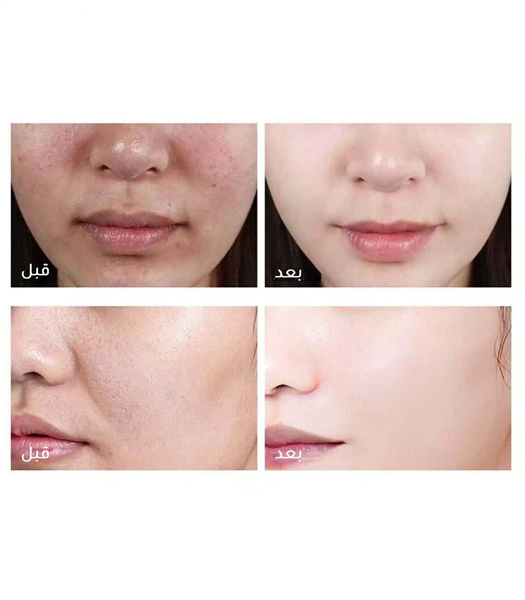 White rice peeling ampoule gives the skin clarity and radiance