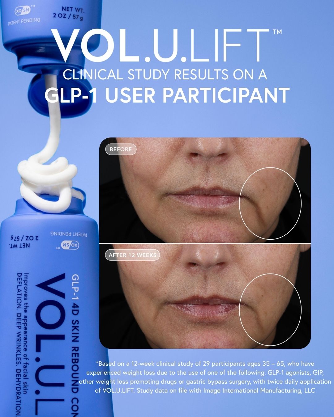 VOL.U.LIFT™ GLP-1 4D Skin Rebound Complex 2 oz / 57 g